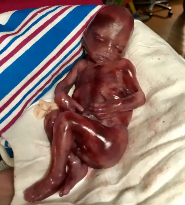 Graysen Blake Bollhoefer