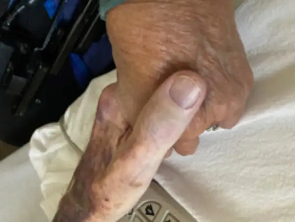 Maguerite "Peg" Atzen