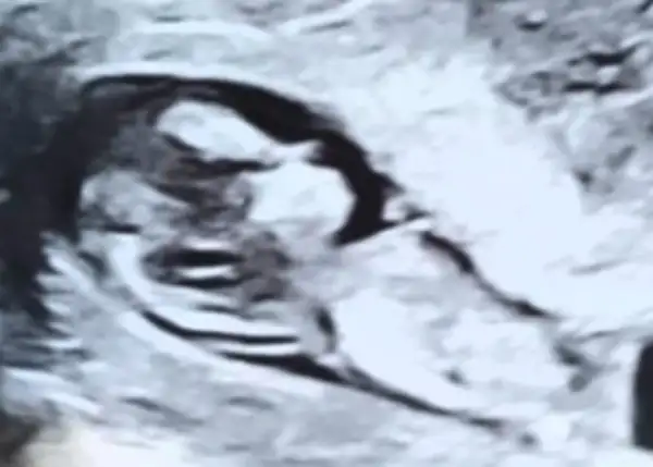 James Reece McElvogue